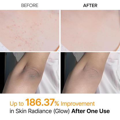 Peel Shot Keratin Kojic Spray