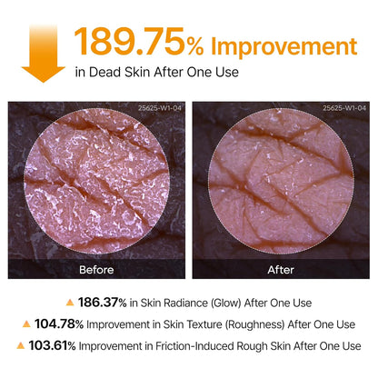 Peel Shot Keratin Kojic Spray
