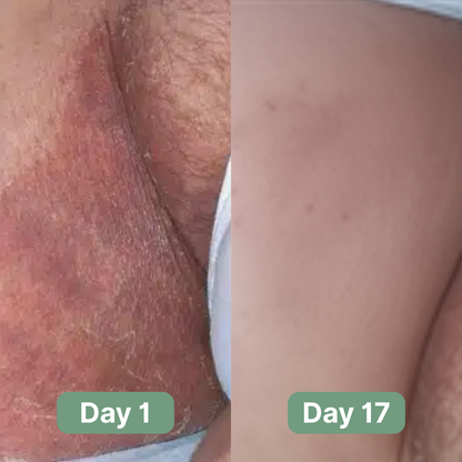 Evina™ Antifungal Soap